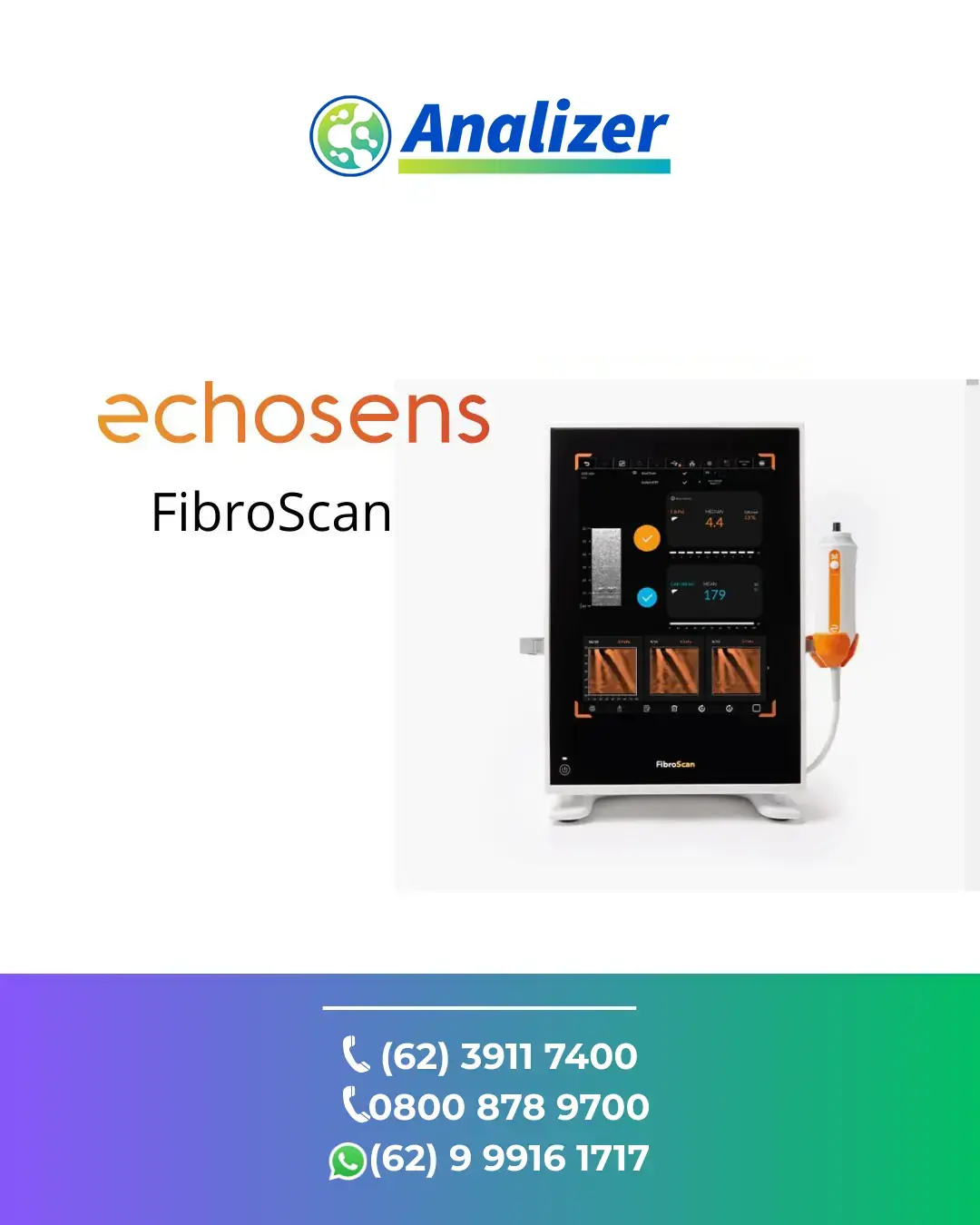 AJUSTE ECHOSENS FIBROSCAN ACRE